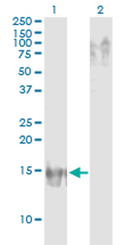 APOB monoclonal antibody (M14), clone 3E5