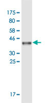 APOB monoclonal antibody (M14), clone 3E5