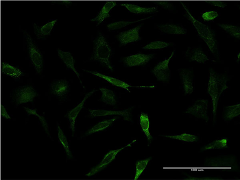 APOA2 monoclonal antibody (M03), clone 1H6