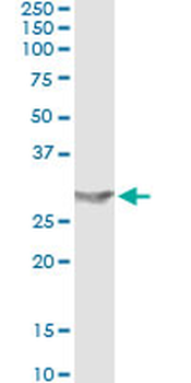 APOA1 monoclonal antibody (M01), clone S1