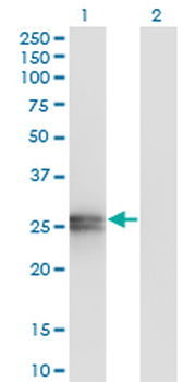 APOA1 monoclonal antibody (M01), clone S1