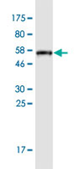 APOA1 monoclonal antibody (M01), clone S1