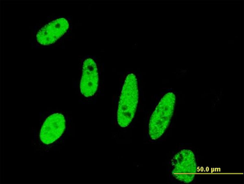 BIRC5 monoclonal antibody (M01), clone 5B10