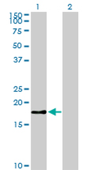 BIRC5 monoclonal antibody (M01), clone 5B10