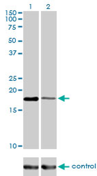 BIRC5 monoclonal antibody (M01), clone 5B10