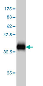 BIRC5 monoclonal antibody (M01), clone 5B10
