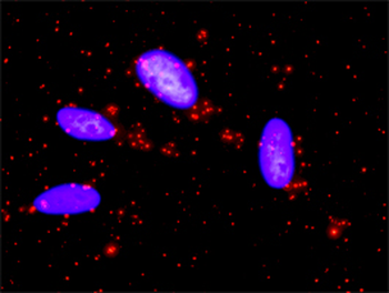 BIRC5 purified MaxPab rabbit polyclonal antibody (D01P)