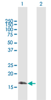 BIRC5 MaxPab rabbit polyclonal antibody (D01)