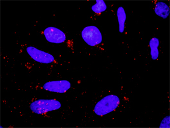 BIRC3 purified MaxPab rabbit polyclonal antibody (D01P)