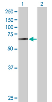 BIRC2 purified MaxPab rabbit polyclonal antibody (D01P)