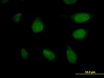 APCS monoclonal antibody (M11), clone 4F3