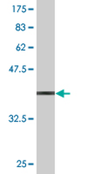 APCS monoclonal antibody (M11), clone 4F3