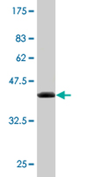 NUDT2 monoclonal antibody (M03), clone S1