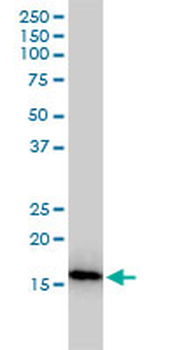 NUDT2 monoclonal antibody (M01), clone 4A4-3C3