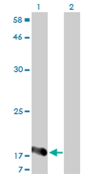NUDT2 monoclonal antibody (M01), clone 4A4-3C3
