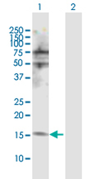 NUDT2 MaxPab rabbit polyclonal antibody (D01)