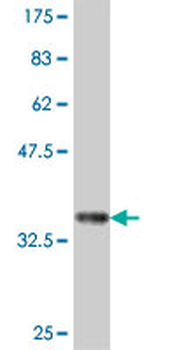 AOC2 polyclonal antibody (A01)