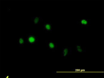 ANXA5 monoclonal antibody (M01), clone 1F4-1A5