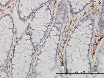 ANXA5 monoclonal antibody (M01), clone 1F4-1A5