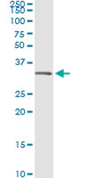 ANXA5 monoclonal antibody (M01), clone 1F4-1A5