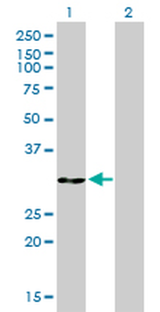 ANXA5 monoclonal antibody (M01), clone 1F4-1A5