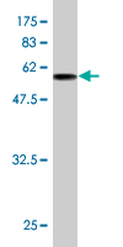ANXA5 monoclonal antibody (M01), clone 1F4-1A5