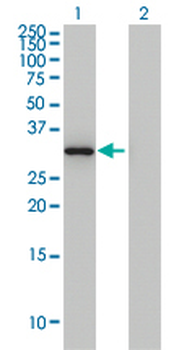 ANXA3 monoclonal antibody (M12), clone 4F1