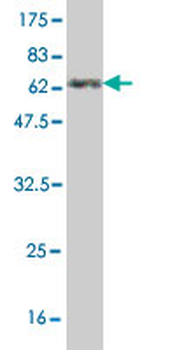 ANXA3 monoclonal antibody (M12), clone 4F1
