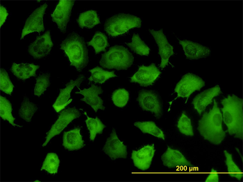 ANXA2 monoclonal antibody (M02), clone 1G7