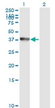 ANXA2 monoclonal antibody (M02), clone 1G7