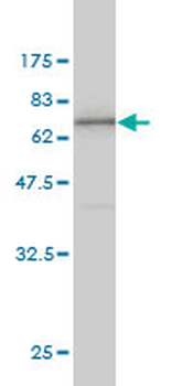 ANXA2 monoclonal antibody (M02), clone 1G7