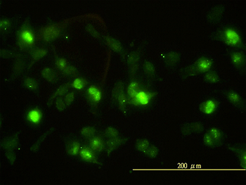 ANXA2 monoclonal antibody (M01), clone 3E8-B6