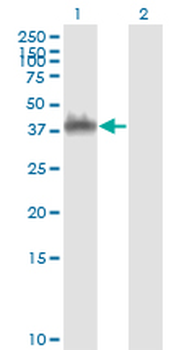 ANXA2 monoclonal antibody (M01), clone 3E8-B6
