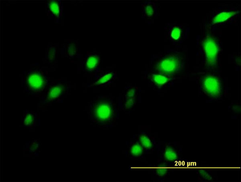 ANXA1 purified MaxPab mouse polyclonal antibody (B01P)