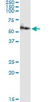 AMY2A MaxPab rabbit polyclonal antibody (D01)