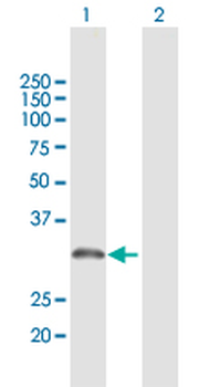 AMT purified MaxPab rabbit polyclonal antibody (D01P)