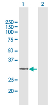 AMT MaxPab rabbit polyclonal antibody (D01)