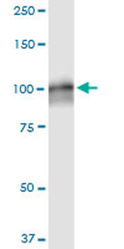 AMPD2 monoclonal antibody (M09A), clone 6A8