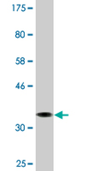 AMPD2 monoclonal antibody (M09A), clone 6A8