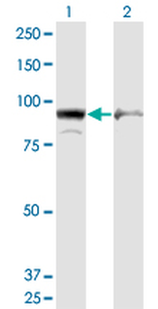 AMPD2 monoclonal antibody (M09), clone 6A8