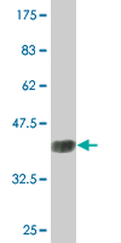 AMPD2 monoclonal antibody (M09), clone 6A8