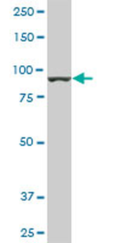 AMPD2 monoclonal antibody (M01A), clone 2F5