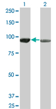 AMPD2 monoclonal antibody (M01A), clone 2F5