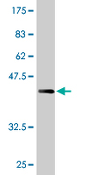AMPD2 monoclonal antibody (M01A), clone 2F5