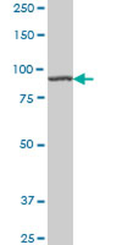 AMPD2 monoclonal antibody (M01), clone 2F5