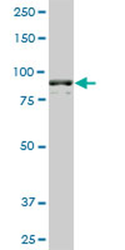 AMPD2 monoclonal antibody (M01), clone 2F5