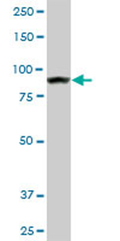 AMPD2 monoclonal antibody (M01), clone 2F5