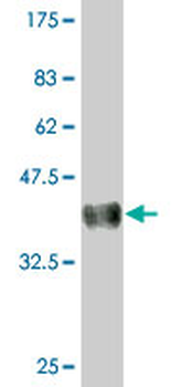 AMPD2 monoclonal antibody (M01), clone 2F5