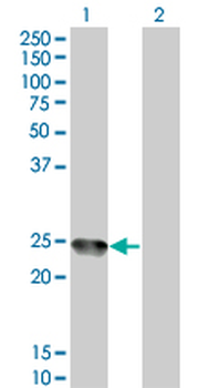 AMELX monoclonal antibody (M04), clone 6G3