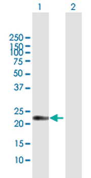 AMELX MaxPab rabbit polyclonal antibody (D01)